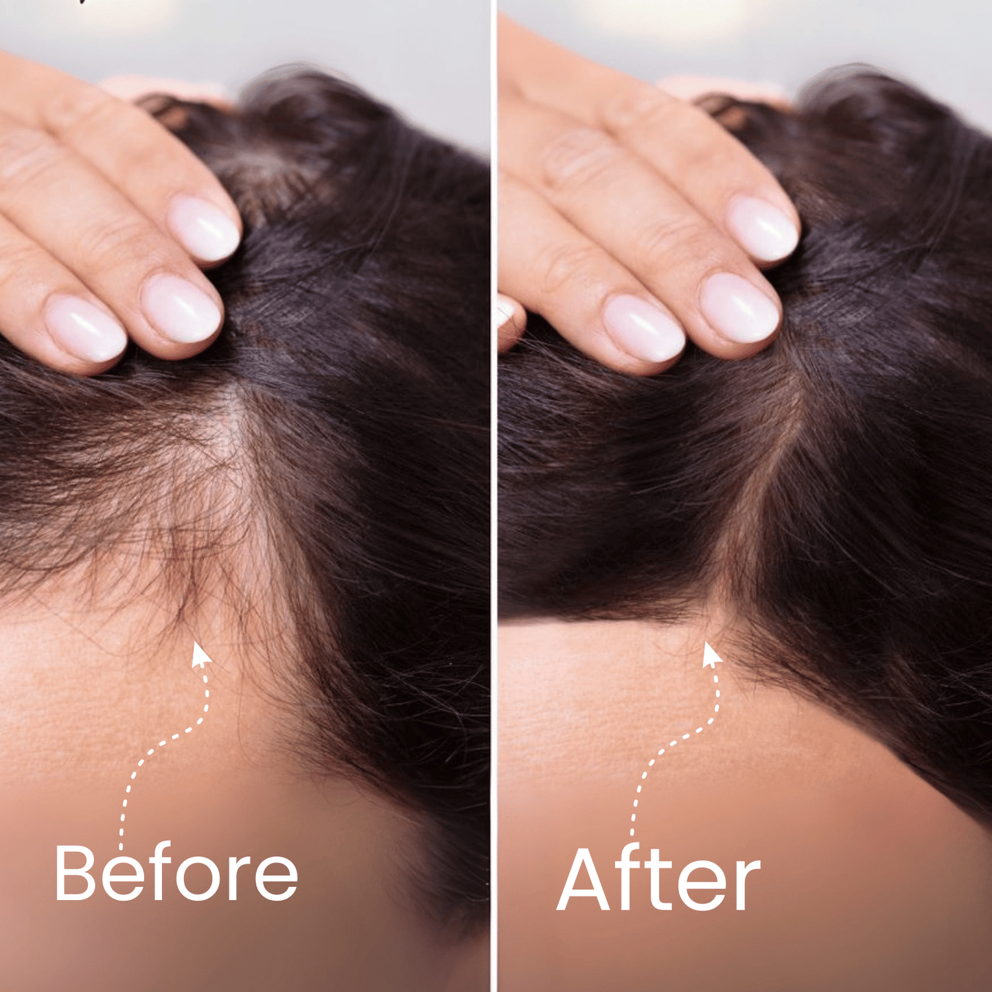 Hair Care Kit Deal Offer