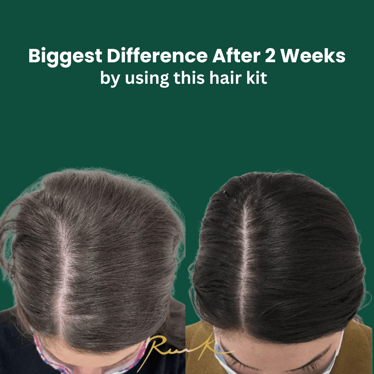 Hair Care Kit Deal Offer