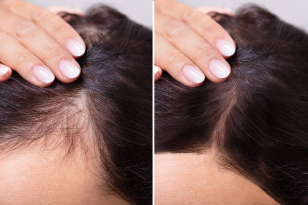 IQ Organic Hub Intense Repair Hair Serum
